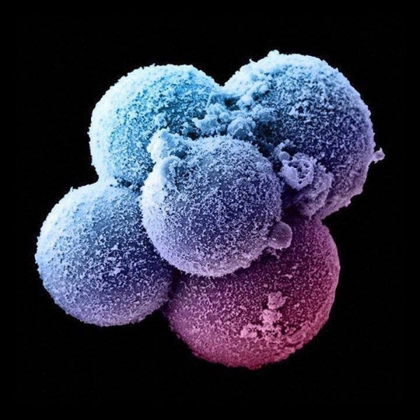 Эмбриональные клетки гадают на генетическом шуме