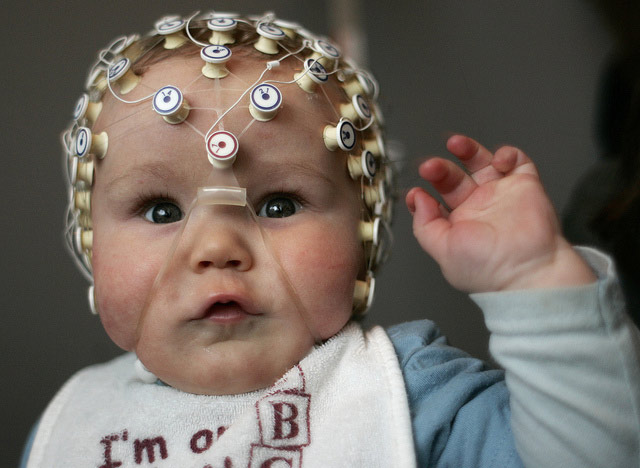 Ультразвук позволяет заглянуть в младенческий мозг