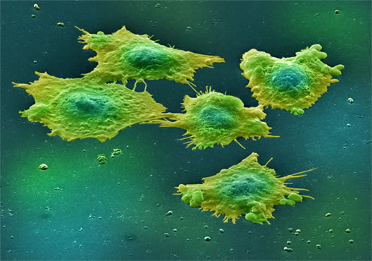 Раковые клетки метастазируют с бактериями