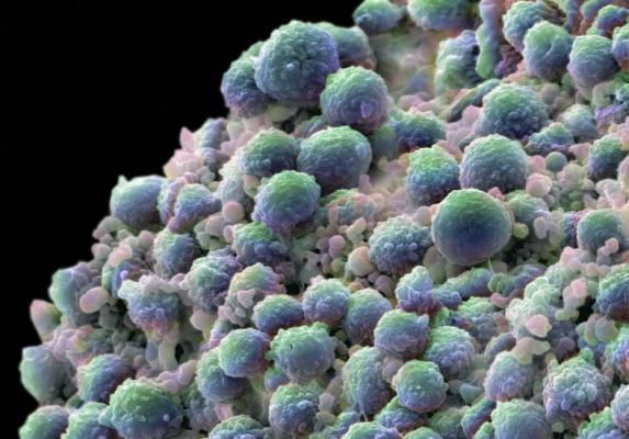 Мутации в некодирующей ДНК помогают раку