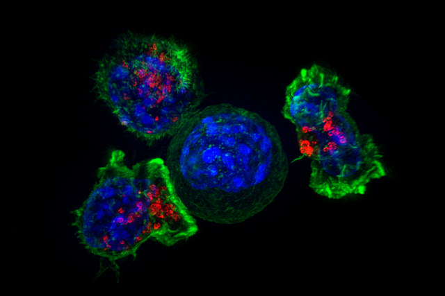 Иммунные клетки охотятся на рак под давлением
